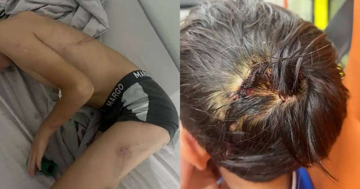 Балқашта соққыға жығылған 8 жасар баланың ісі бойынша тың деректер жарияланды