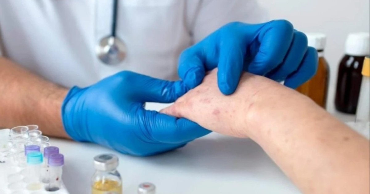 Екі мыңға жуық қазақстандық қызылшамен ауырған - ДСМ