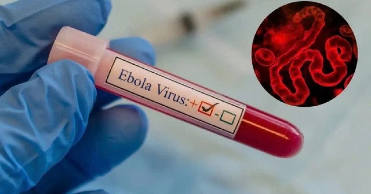 Денсаулық сақтау министрлігі эбола вирусына байланысты ескерту жасады