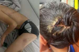 Балқашта соққыға жығылған 8 жасар баланың ісі бойынша тың деректер жарияланды