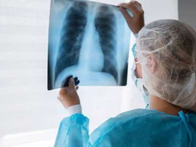 АИТВ жұқтырған адамдарда туберкулездің даму қаупі ерекше – астаналық дәрігер