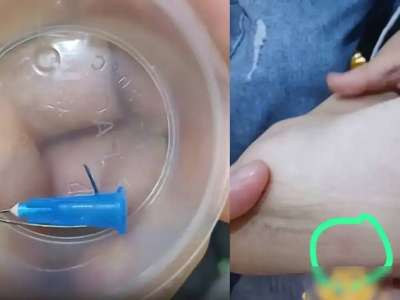 «Енді 6 ай дәрігерге апаруым керек»: Астанадағы кафеде баланың аяғына медициналық шприц кіріп кеткен