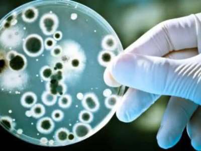 Жыл  басынан бері елімізде 17 адам сібір жарасын жұқтырған