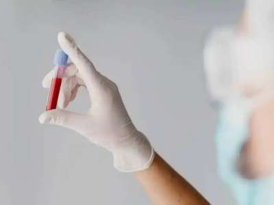 АИТВ туралы ашық сөйлесейік – эпидемиолог